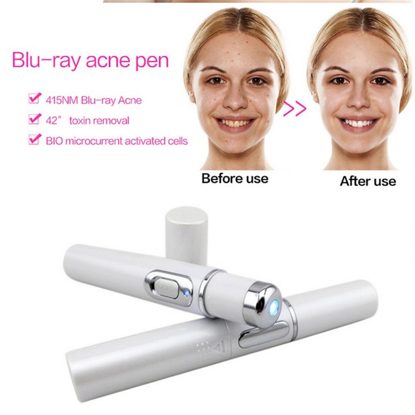 Stylo "Pure-Ray" – Thérapie Lumière Bleue Anti-Acné & Réparateur de Cicatrices