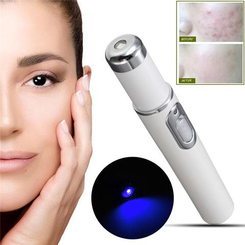 Stylo "Pure-Ray" – Thérapie Lumière Bleue Anti-Acné & Réparateur de Cicatrices