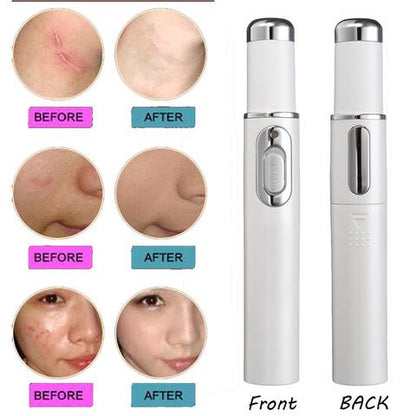 Stylo "Pure-Ray" – Thérapie Lumière Bleue Anti-Acné & Réparateur de Cicatrices