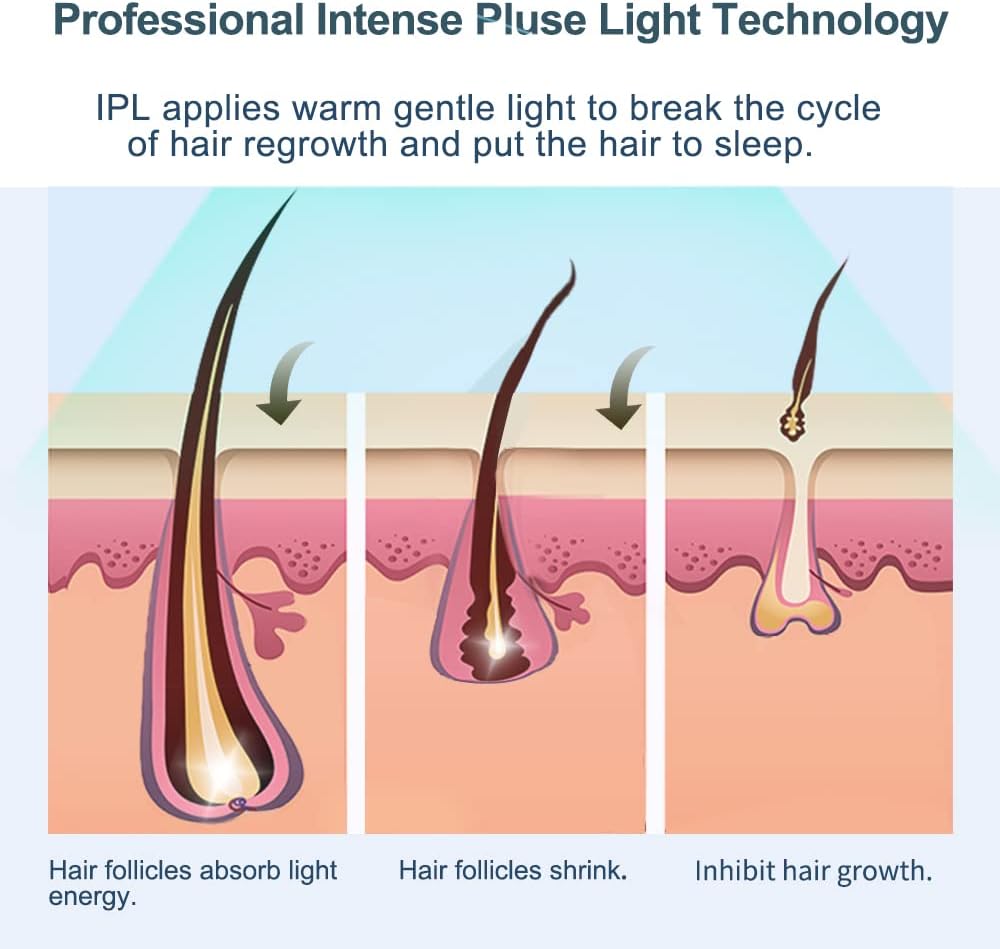 Épilateur Lumière Pulsée IPL Dépilation - Glace Refroidissement Sans Douleur & 1 Accessoire de Précision & 500000 Flashs pour Visage, Corps, le Maillot et les Aisselles, Laser Appareil Epilation