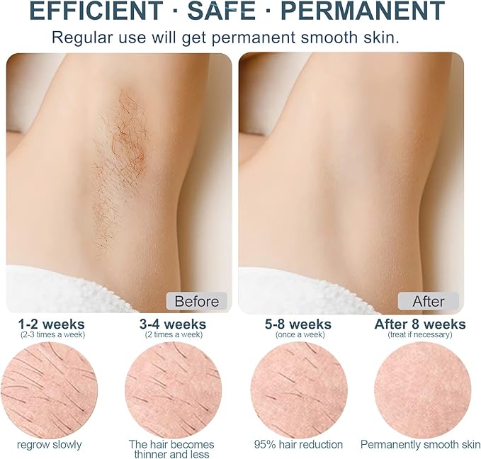Épilateur Lumière Pulsée IPL Dépilation - Glace Refroidissement Sans Douleur & 1 Accessoire de Précision & 500000 Flashs pour Visage, Corps, le Maillot et les Aisselles, Laser Appareil Epilation